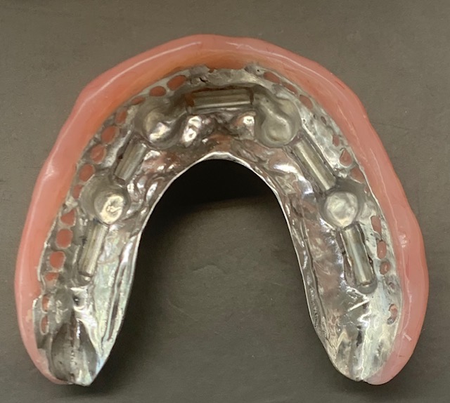 C/C 8 TOOTH DENTURE